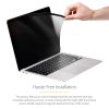 StarTech.com Laptop Privacy Screen for 13 inch MacBook Pro & MacBook Air - Magnetic Removable Security Filter - Blue Light Reduc - Image 11